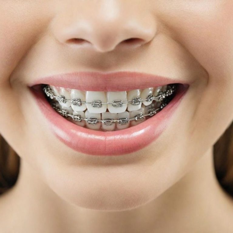 Lächelnde junge Person mit Zahnspange und gesunden, weißen Zähnen.